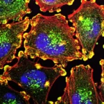 Beyond the Data: A Patient’s Journey Through the Frontier of mRNA Cancer Vaccines