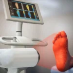 Beyond the Pinch: New Optical Imaging Technology Could Revolutionize Scleroderma Monitoring