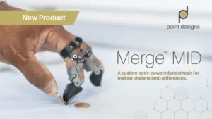 Breakthrough in Prosthetic Innovation: Point Designs Unveils Merge MID for Mid-Phalanx Amputations, Redefining Independence