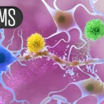 Investigational CAR T-Cell Therapy Zola-Cel Under Scrutiny Following Fatal Event in MS Trial