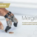 Point Designs Unveils Merge MID: A Breakthrough Body-Powered Prosthesis Addressing a Critical Clinical Gap