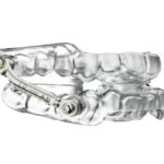 The Evolution of Oral Appliance Therapy: A Comprehensive Review of Modern Mandibular Advancement Devices