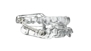 The Evolution of Oral Appliance Therapy: A Comprehensive Review of Modern Mandibular Advancement Devices