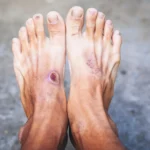 The Immune Paradox: Unlocking the Biological Secrets of Chronic Diabetic Wound Healing