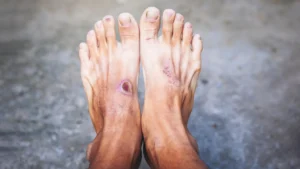 The Immune Paradox: Unlocking the Biological Secrets of Chronic Diabetic Wound Healing