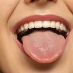 The Molecular Mystery: Why COVID-19 Causes Long-Term Taste Dysfunction