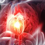 The Silent Storm: U.S. Heart Failure Patients Face Disproportionate Inflammatory Risk